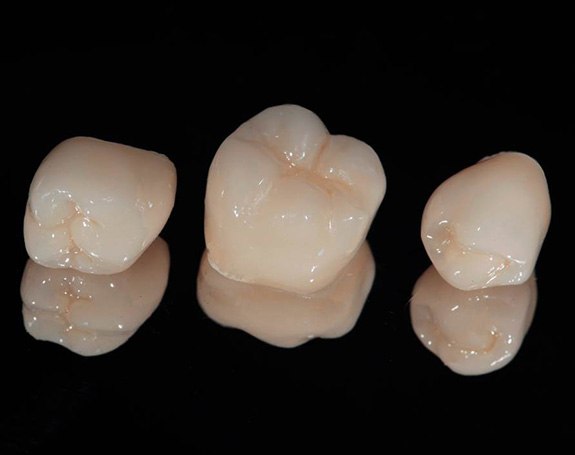 Three dental crowns on dark reflective surface
