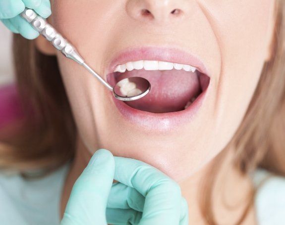 Dentist examining smile after metal free dental restoration