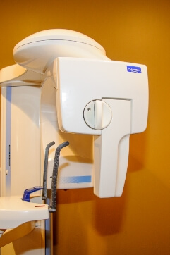 3 D C T cone beam digital x-ray scanner