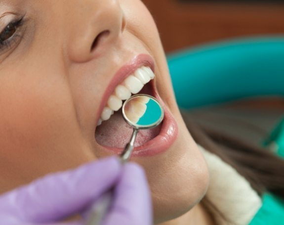 Dentist examining smile after tooth colored filling treatment