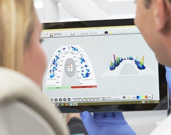 Dentist and patient looking at cavity detection system report