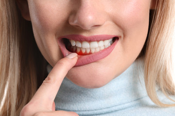 person pointing to their gums