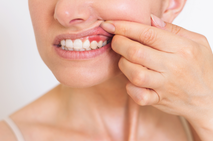 Close up of woman's mouth with inflamed gums